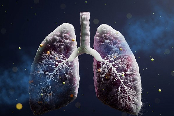 Lung Infection Symptoms